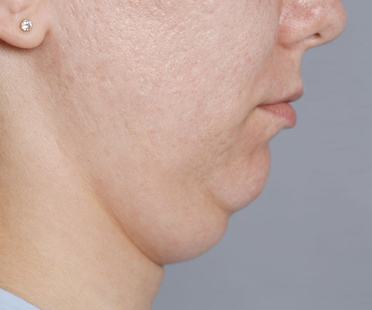 02 seccion about1 (2)