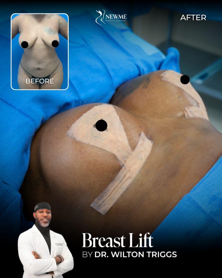 Dr. Triggs BreastLift